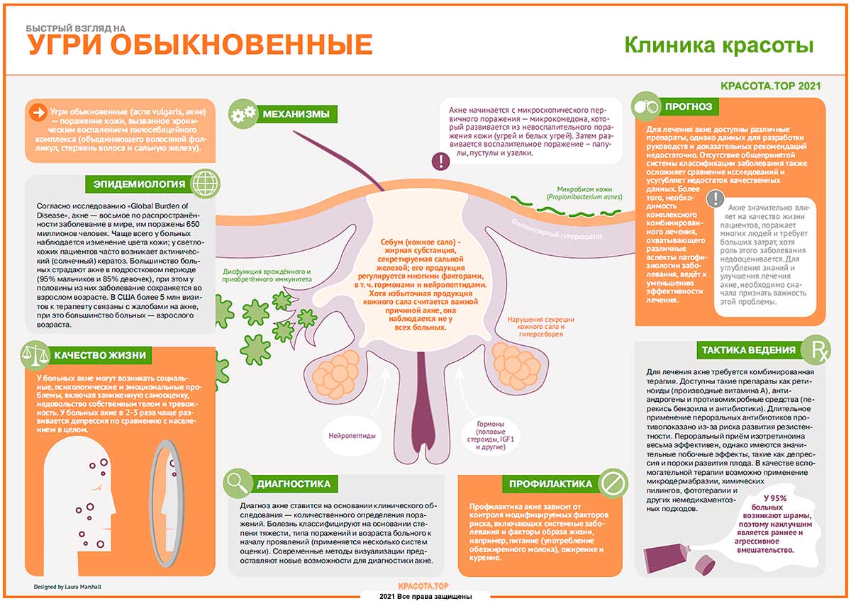 Акне: виды заболевания и причины появления